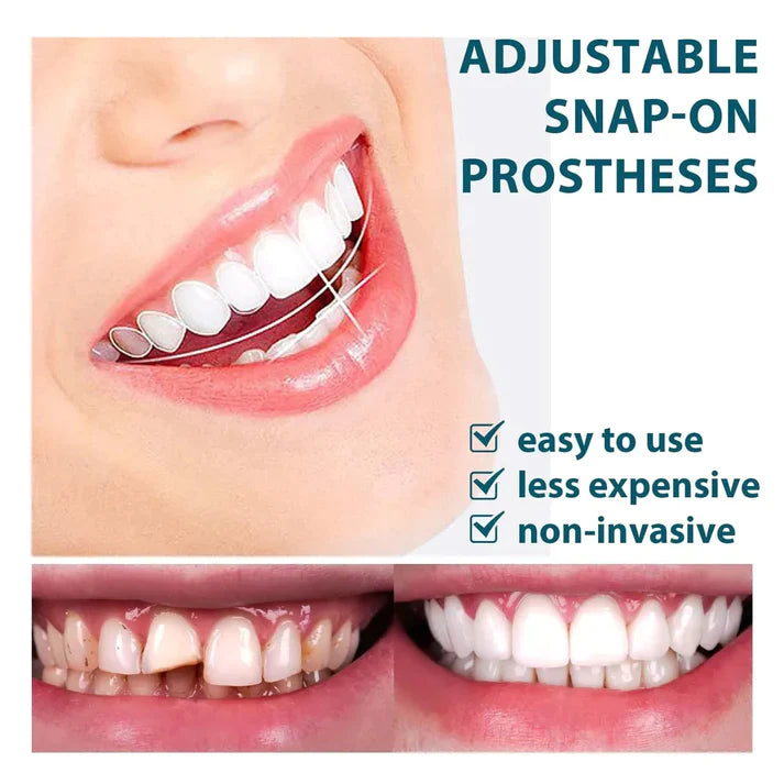 Homelae™ Flexible Denture Cover
