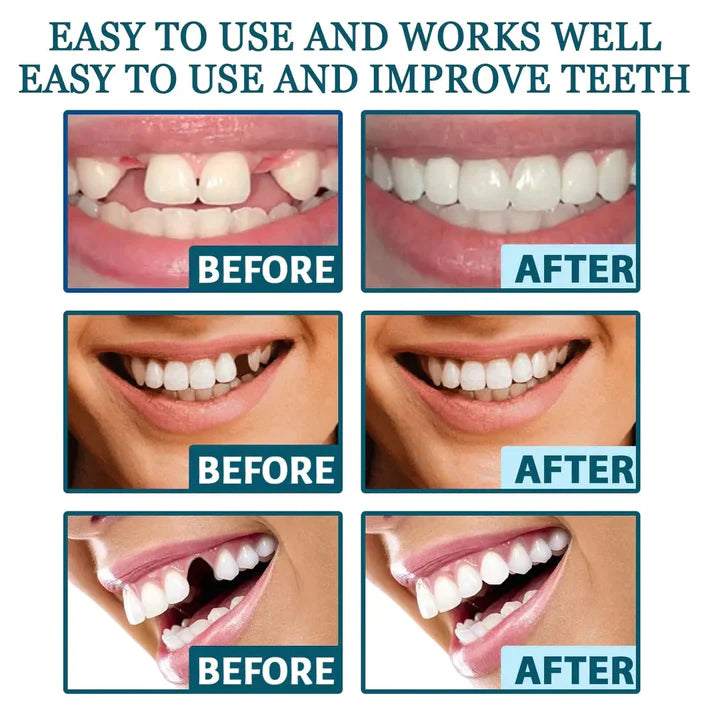 Homelae™ Flexible Denture Cover