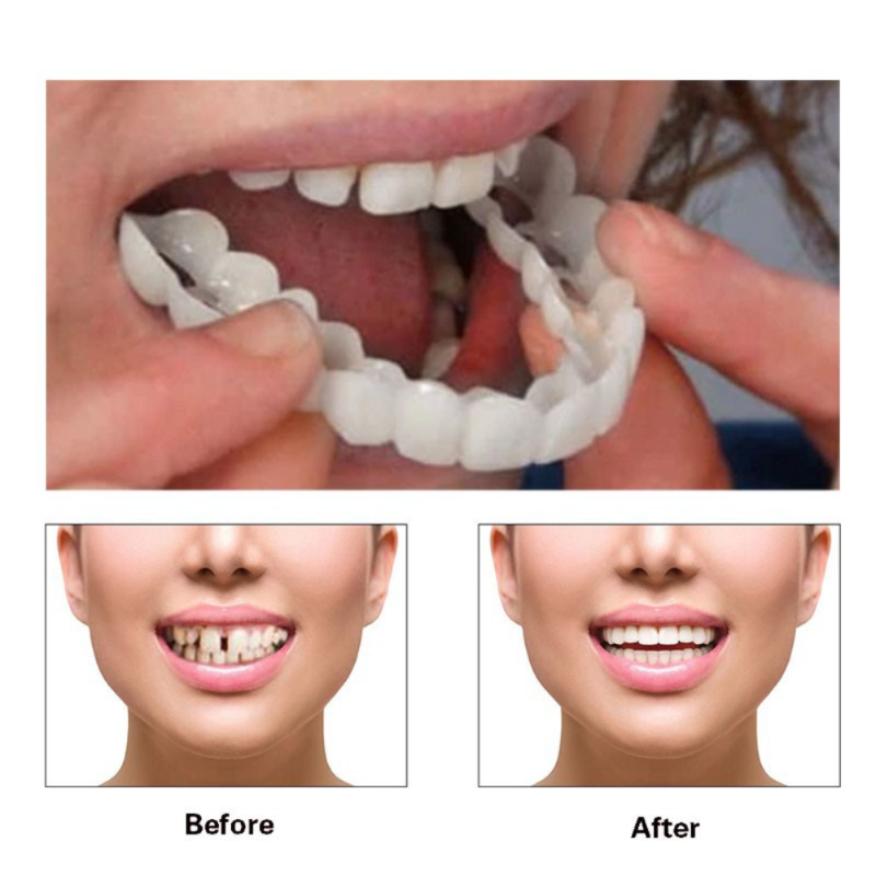 Homelae™ Flexible Denture Cover