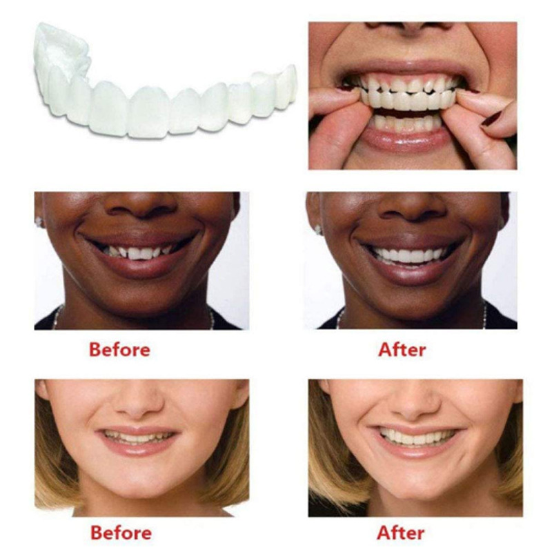 Homelae™ Flexible Denture Cover